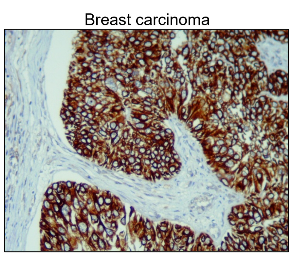 IR235-880 anti-Cytokeratin 14/17 antibody IHC image