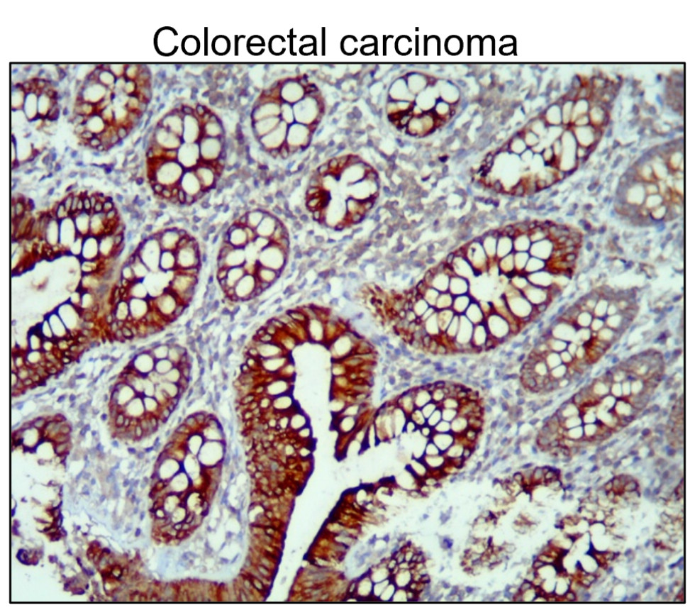 IR235-880 anti-Cytokeratin 14/17 antibody IHC image