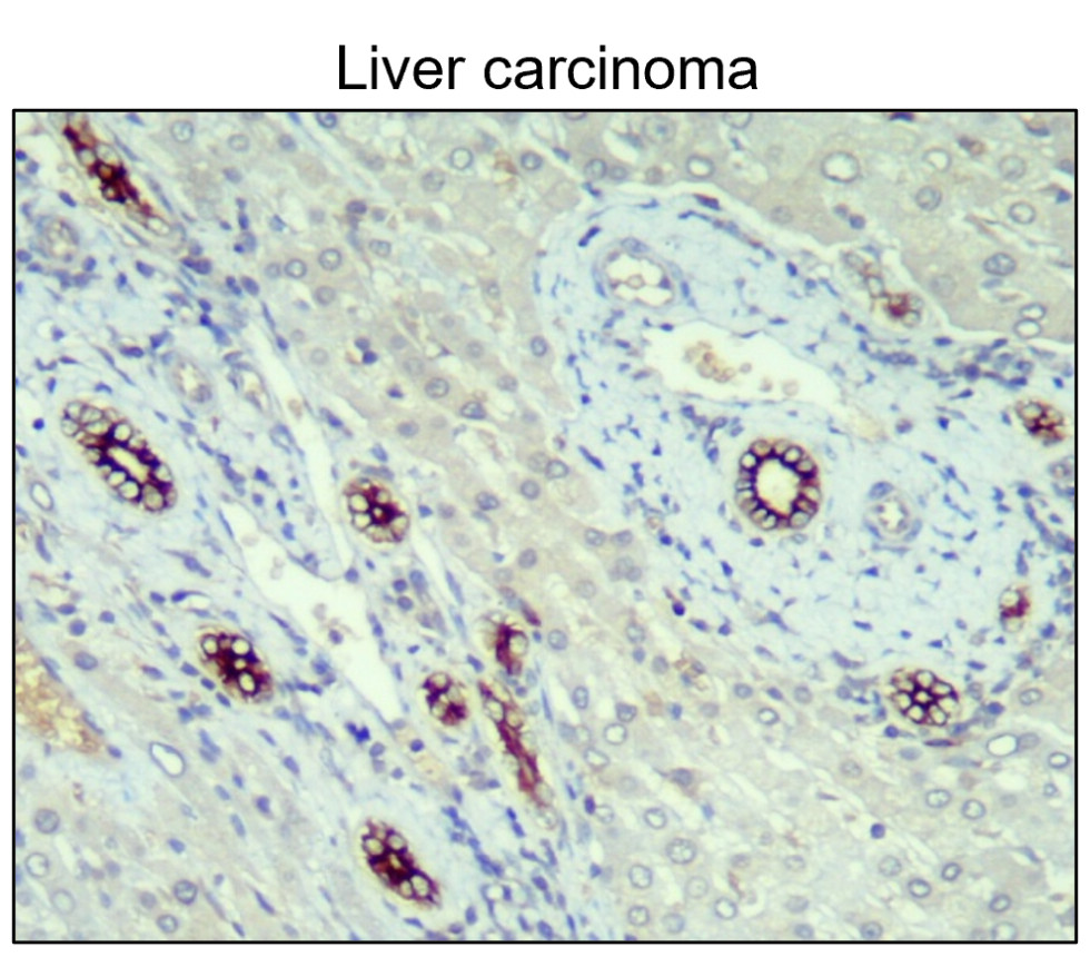 IR235-880 anti-Cytokeratin 14/17 antibody IHC image