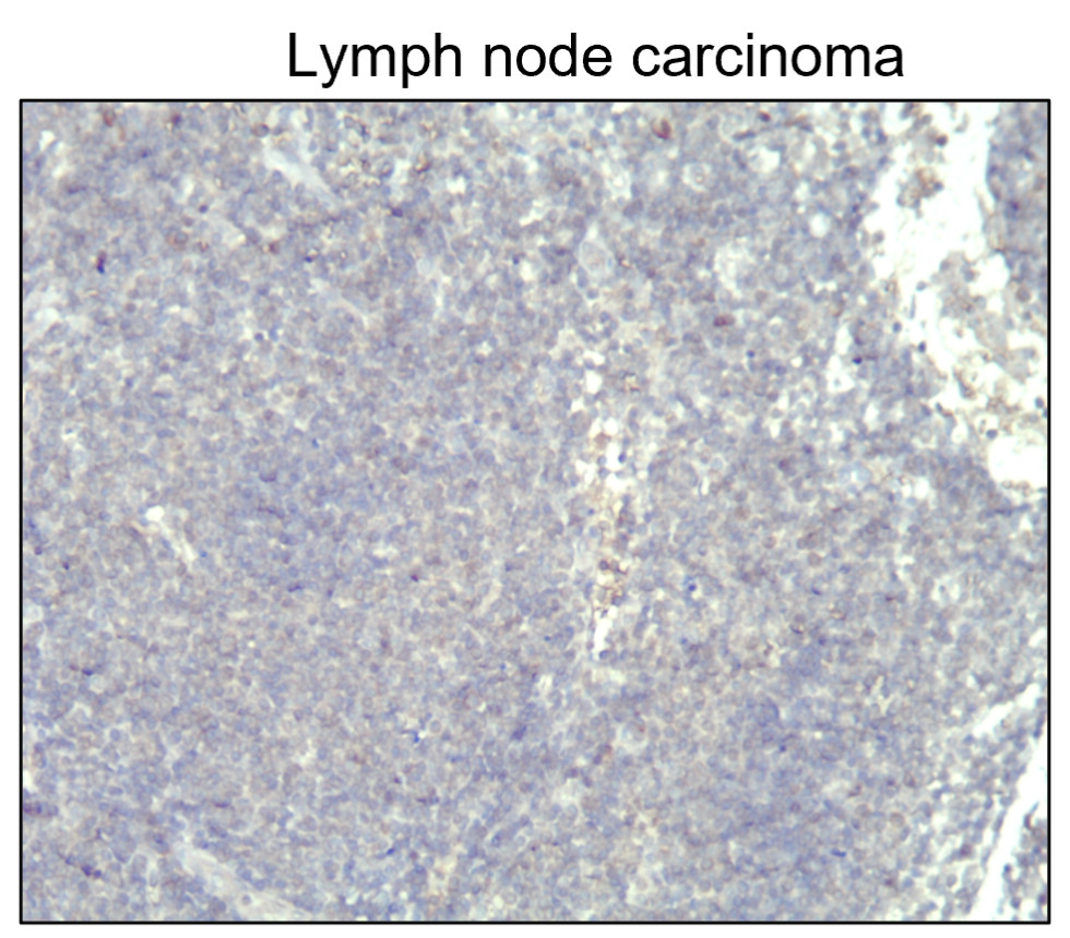 IR235-880 anti-Cytokeratin 14/17 antibody IHC image