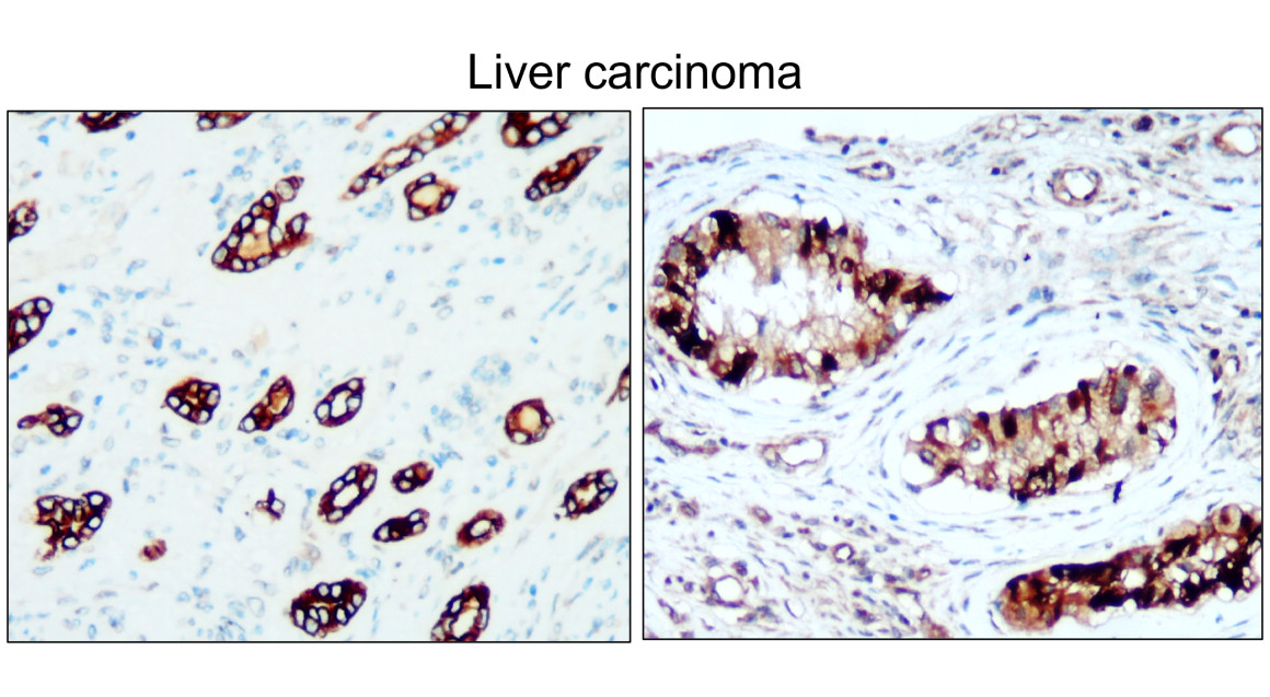 IR229-871 anti-Cytokeratin 8 antibody IHC image