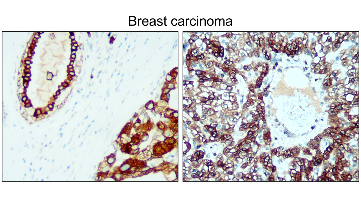 IR229-871 anti-Cytokeratin 8 antibody IHC image