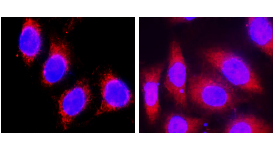 IR229-871 anti-Cytokeratin 8 antibody ICC/IF image