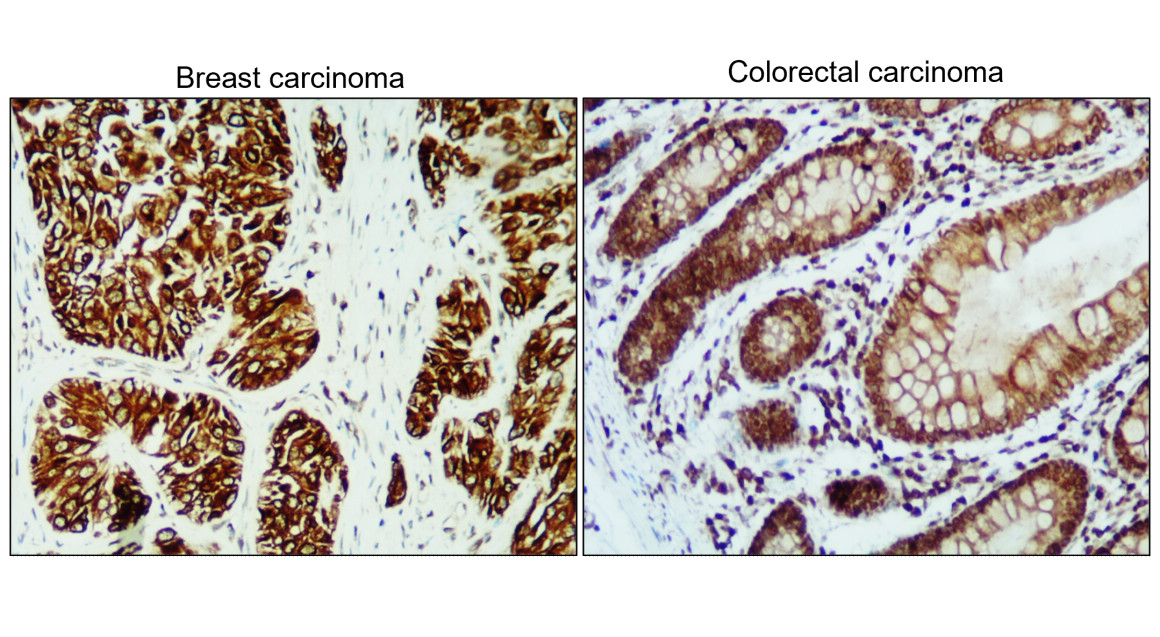 IR226-865 anti-Cytokeratin 5/6 antibody IHC image