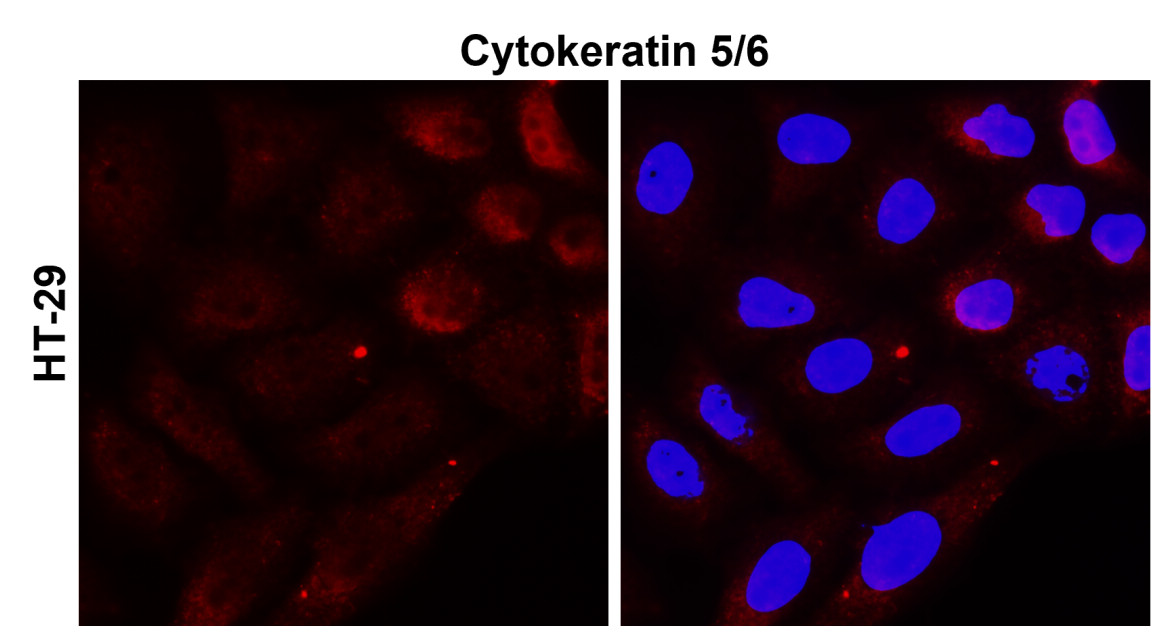 IR226-865 anti-Cytokeratin 5/6 antibody ICC/IF image