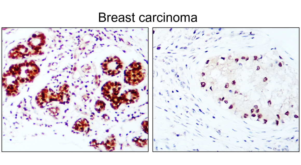 IR213-777 anti- Estrogen Receptor alpha antibody IHC image