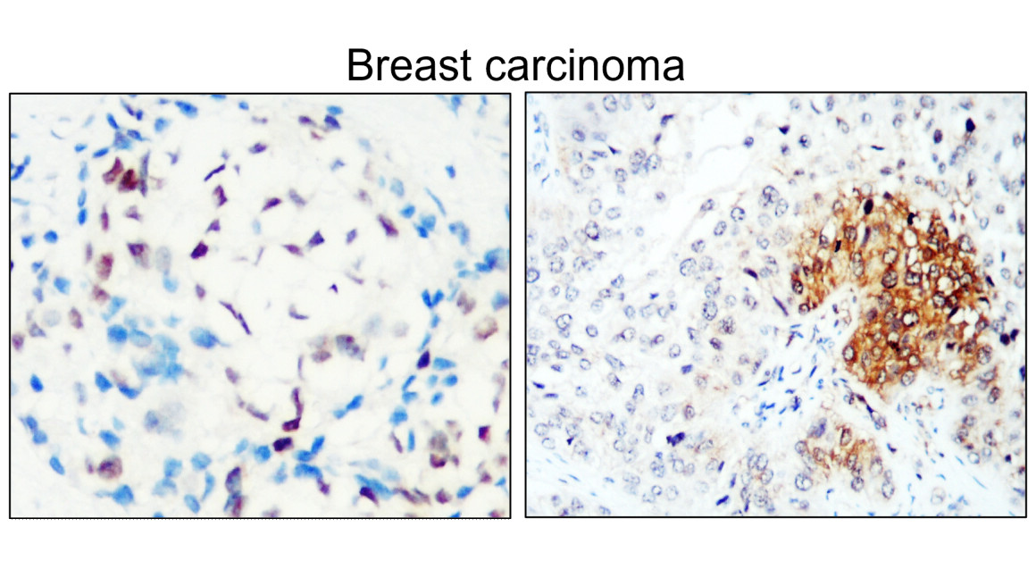 IR213-777 anti- Estrogen Receptor alpha antibody IHC image