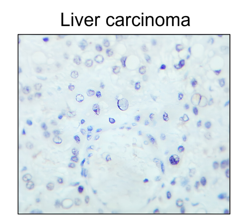 IR213-777 anti- Estrogen Receptor alpha antibody IHC image