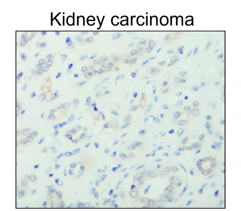 IR213-777 anti- Estrogen Receptor alpha antibody IHC image