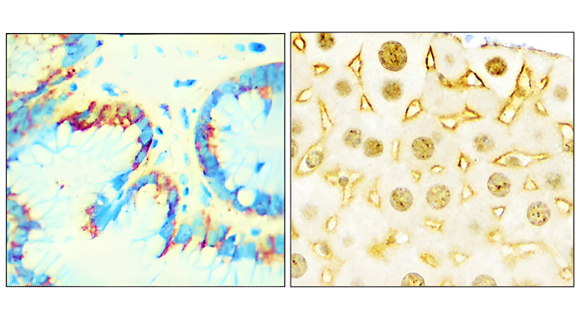 IR211-769 anti-EGFR antibody IHC image