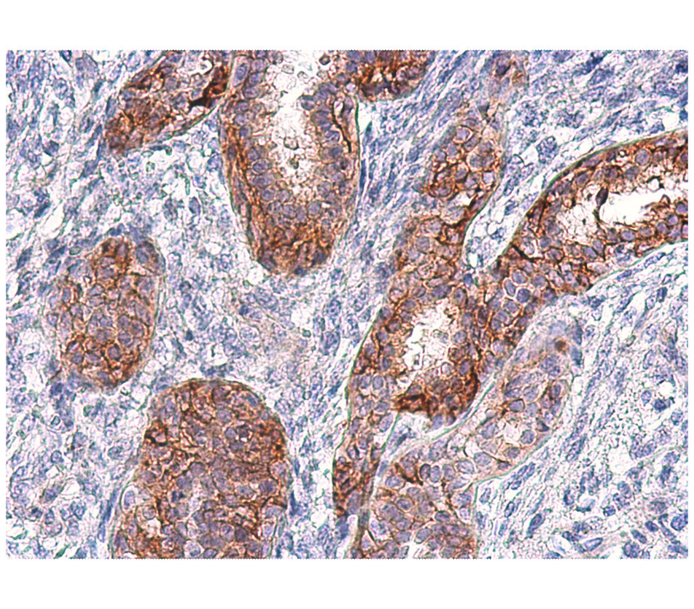 IR211-769 anti-EGFR antibody IHC image