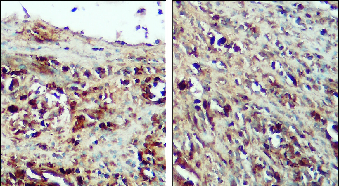 IR100-414 anti-Caspase 9 cleaved Asp315 antibody IHC image