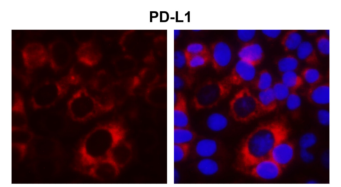 IR167-645 anti-PD-L1 antibody ICC/IF image