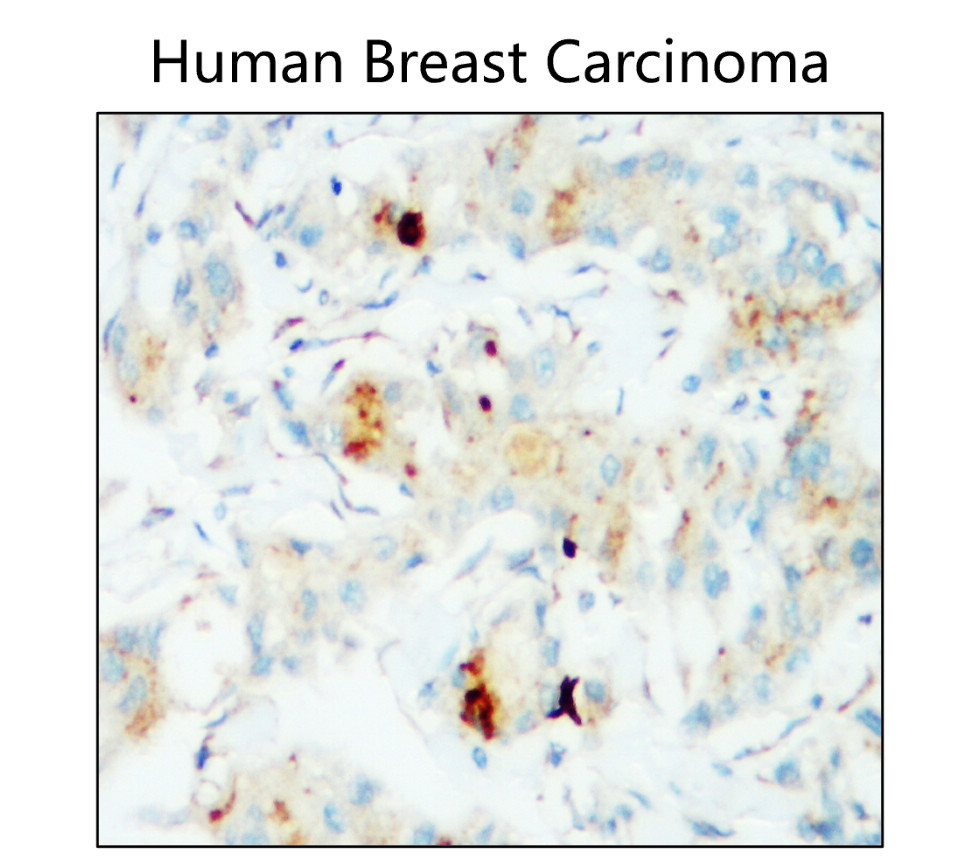 IR167-643 anti-PD-L1 antibody IHC image