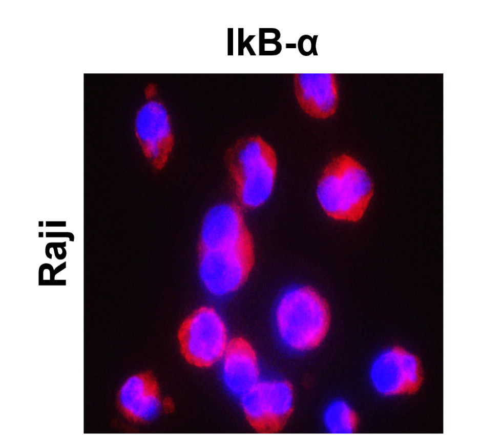 IR145-580 anti- IκBα antibody ICC/IF image