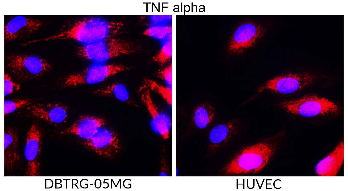 IR106-P2 anti-TNF alpha antibody ICC/IF image