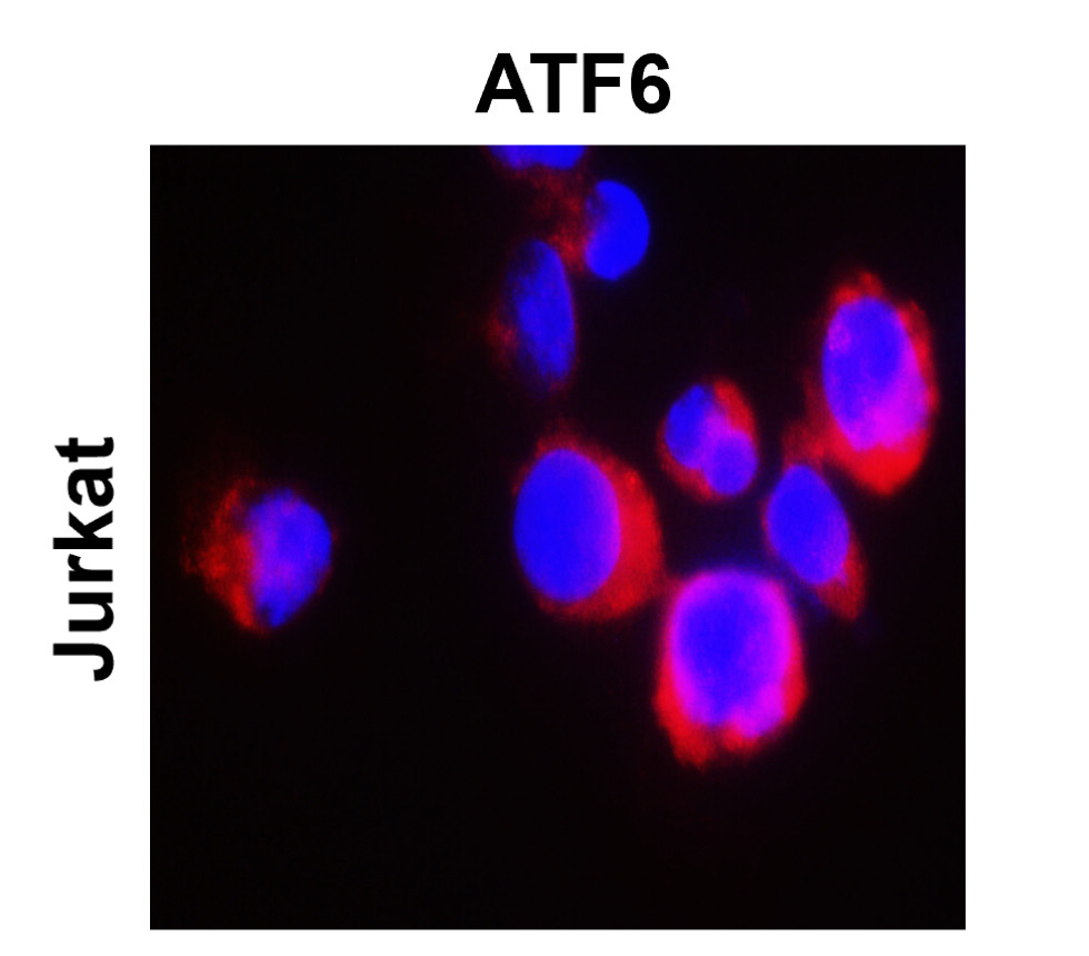 IR132-533 anti-ATF6 antibody ICC/IF image