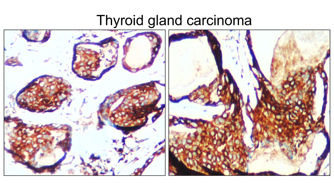 IR130-525 anti-BiP / GRP78 antibody IHC image