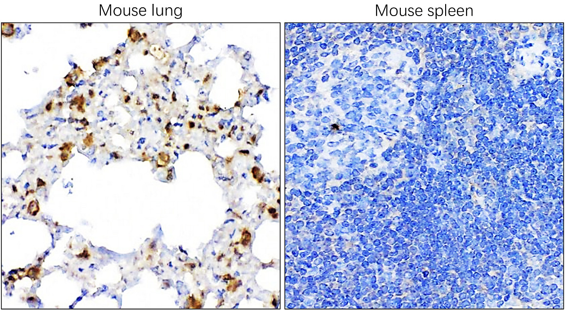 IR350-950 anti-Thyroid Transcription Factor 1 antibody IHC image