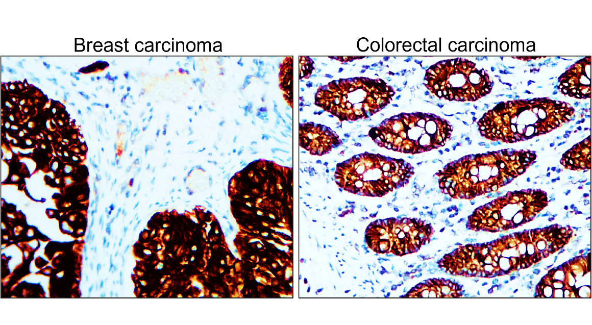 IR222-861 anti-pan Cytokeratin antibody IHC image