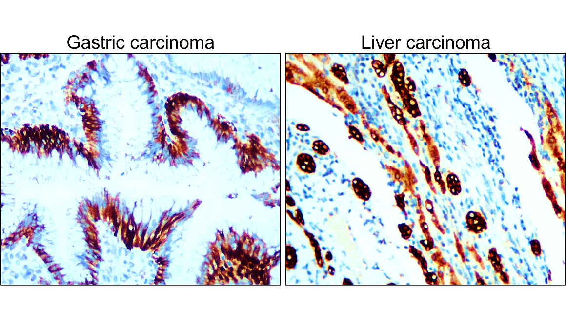 IR222-861 anti-pan Cytokeratin antibody IHC image