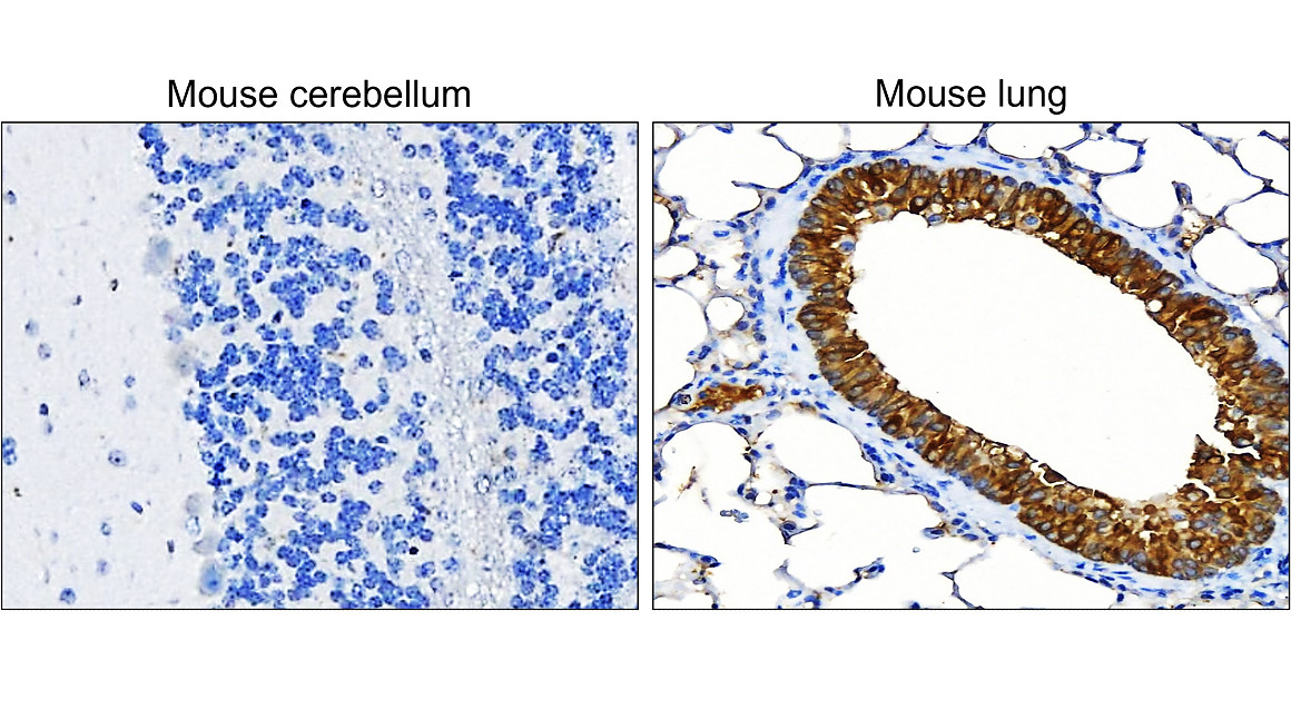 IR222-861 anti-pan Cytokeratin antibody IHC image