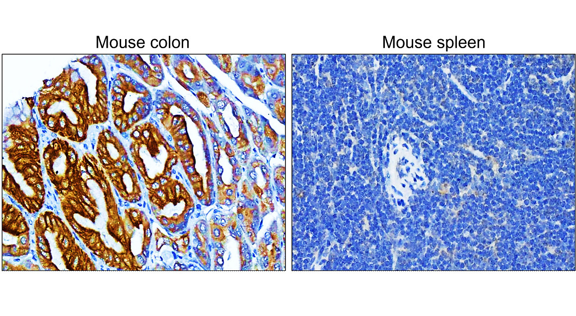 IR222-861 anti-pan Cytokeratin antibody IHC image