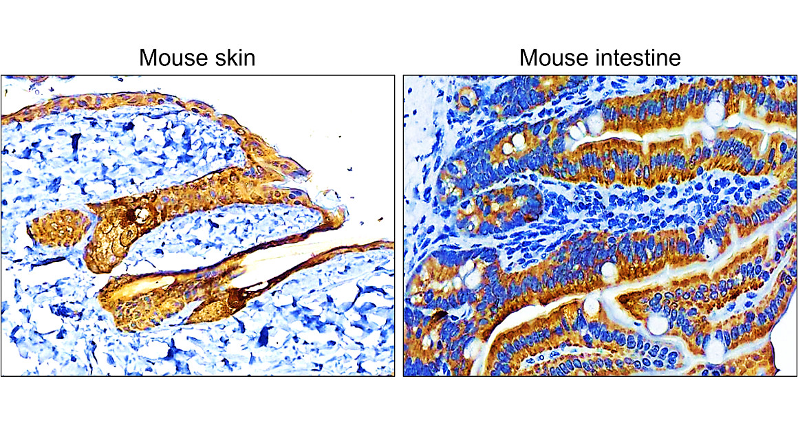 IR222-861 anti-pan Cytokeratin antibody IHC image