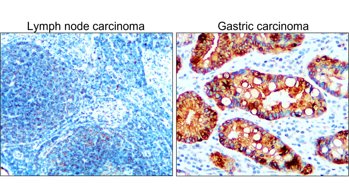 IR222-861 anti-pan Cytokeratin antibody IHC image