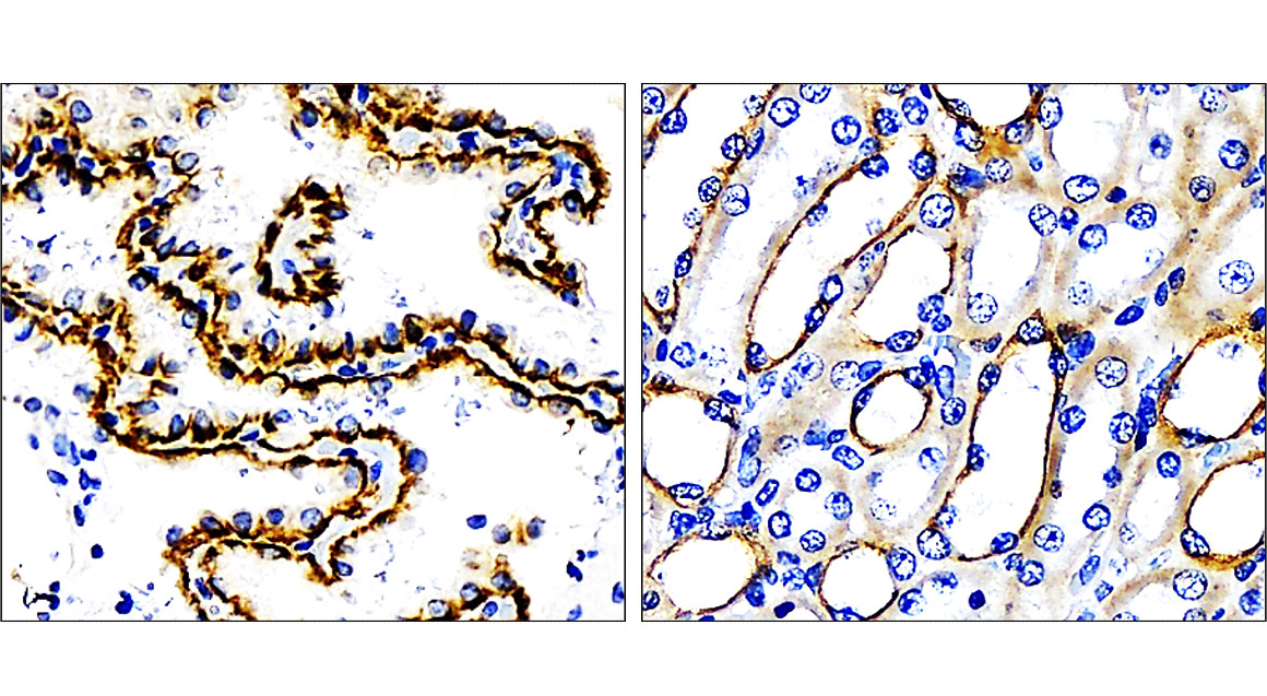 IR228-868 anti-Cytokeratin 7 antibody IHC image