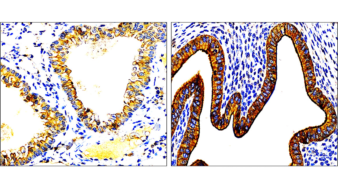 IR228-868 anti-Cytokeratin 7 antibody IHC image