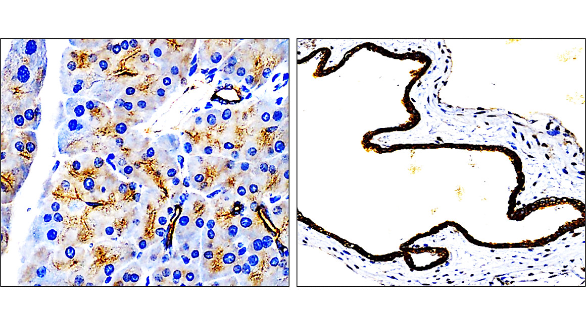 IR228-868 anti-Cytokeratin 7 antibody IHC image