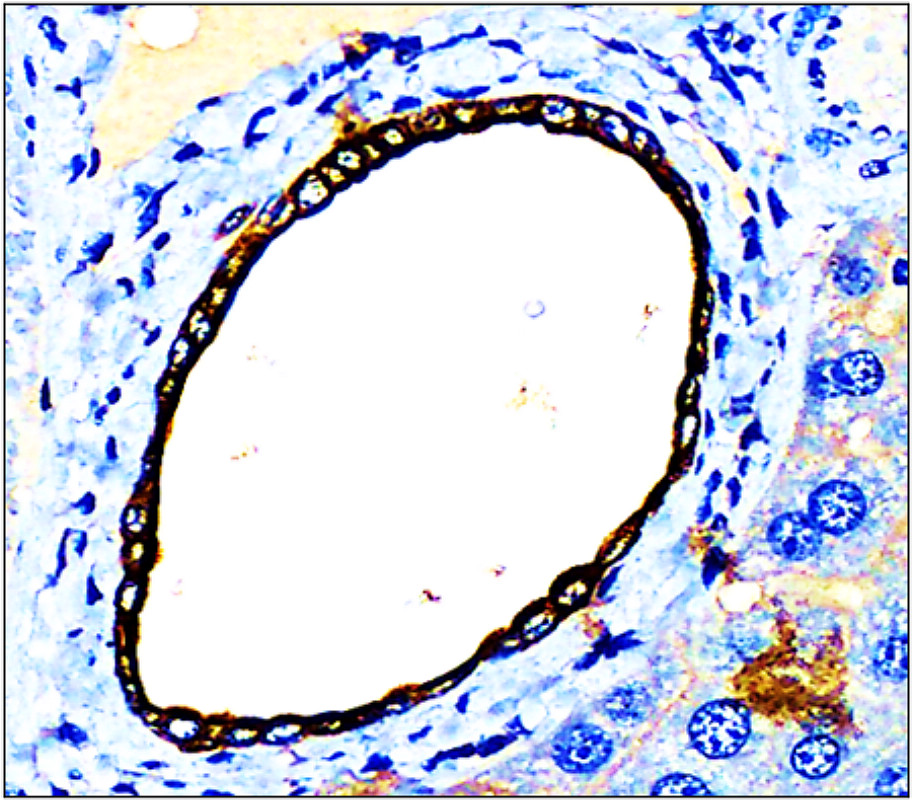 IR228-868 anti-Cytokeratin 7 antibody IHC image