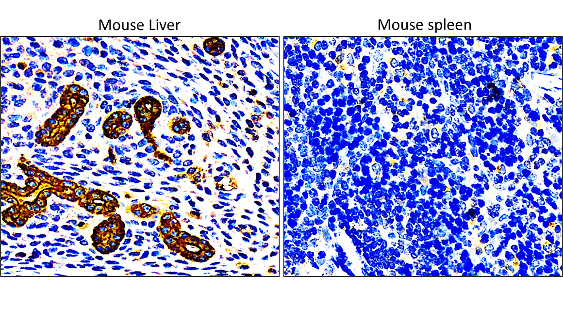 IR228-868 anti-Cytokeratin 7 antibody IHC image