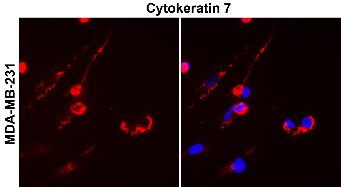 IR228-868 anti-Cytokeratin 7 antibody ICC/IF image