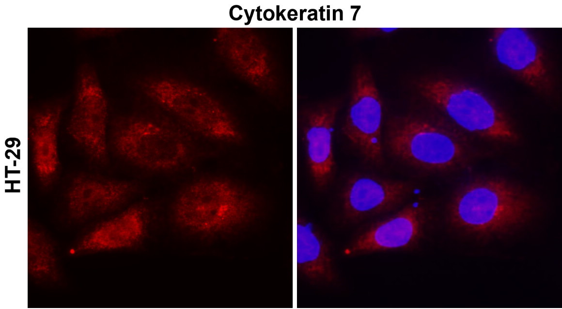 IR228-868 anti-Cytokeratin 7 antibody ICC/IF image