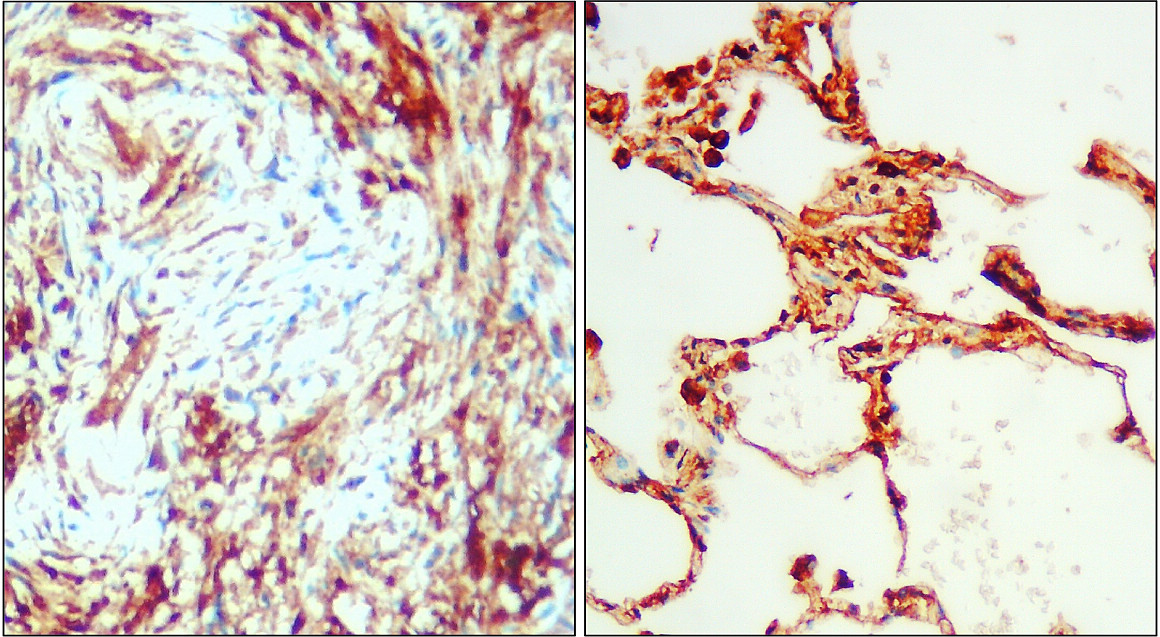 IR74-P1 anti-IL6 antibody IHC image