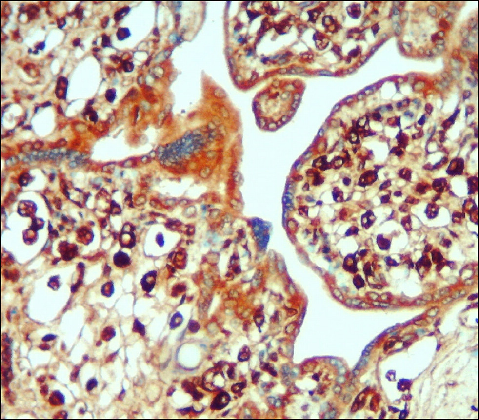 IR74-P1 anti-IL6 antibody IHC image