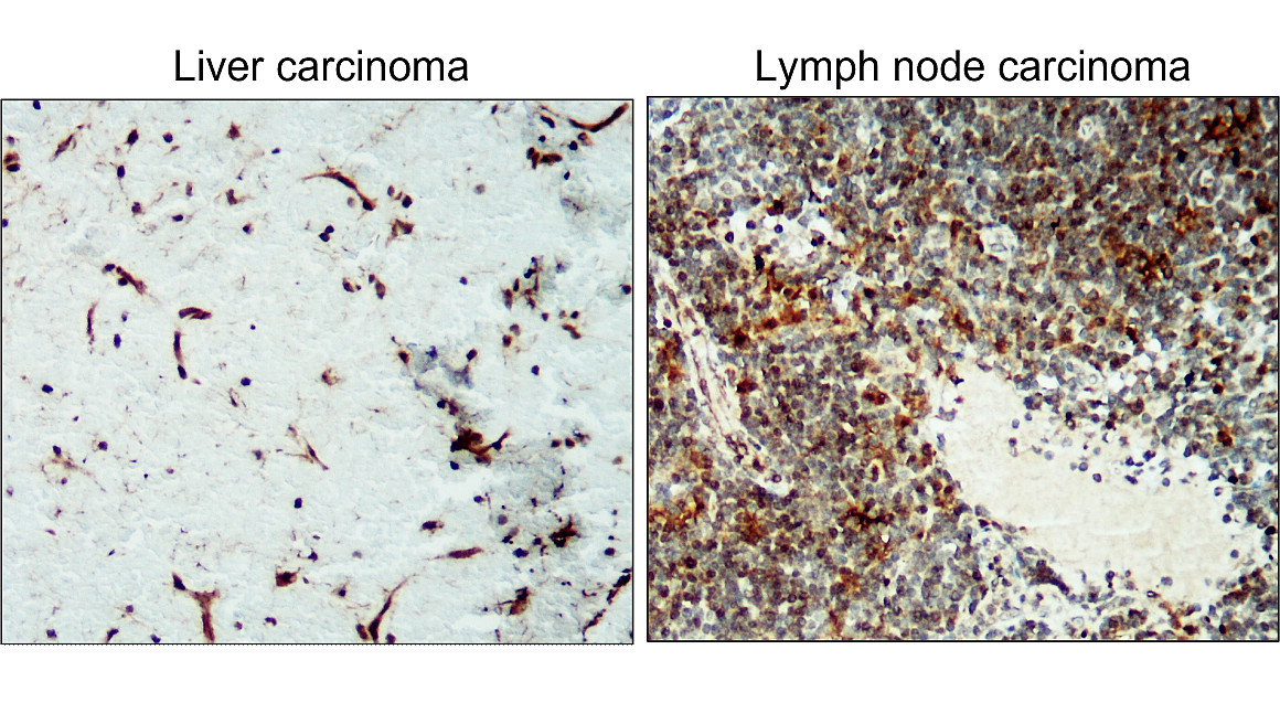 IR78-268 anti-ICAM-1 / CD54 antibody IHC image