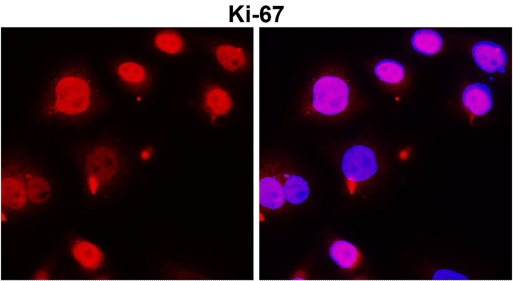 IR212-772 anti- Ki-67 antibody ICC/IF image