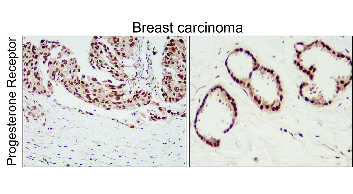 IR215-787 anti- Progesterone Receptor antibody IHC image