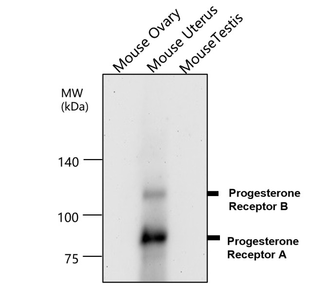 IR215-787 anti- Progesterone Receptor antibody WB image