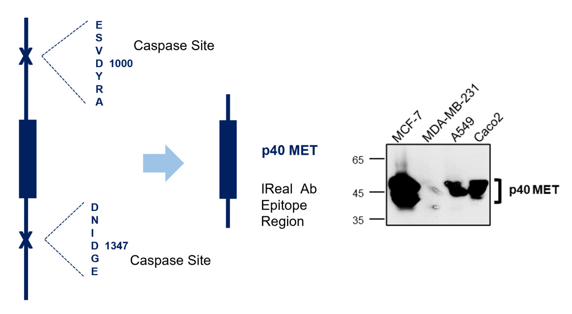 IR219-807 anti c-MET antibody WB image