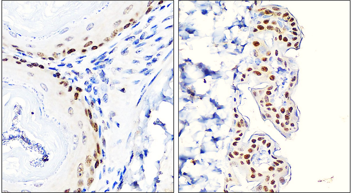 Customer feedback IR205-742 anti- p63 antibody IHC image