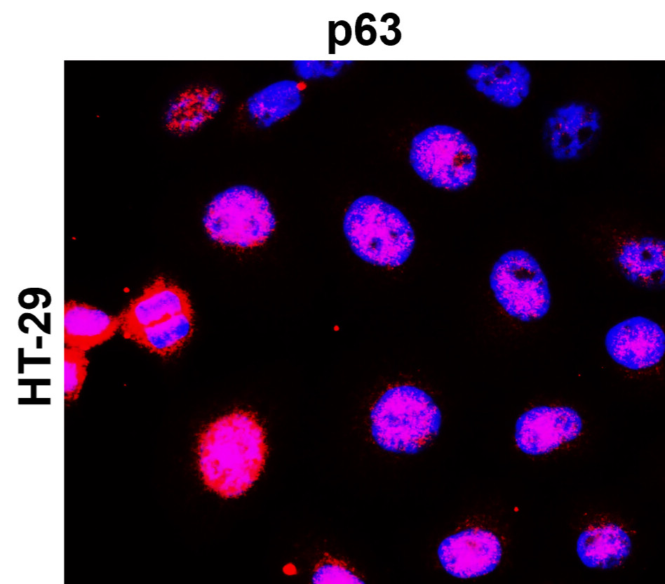 IR205-742 anti- p63 antibody ICC/IF image