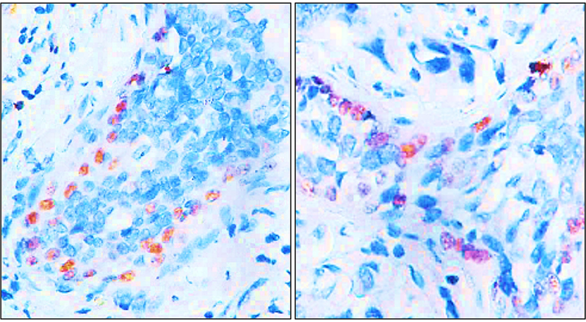 Customer feedback IR205-742 anti- p63 antibody IHC image