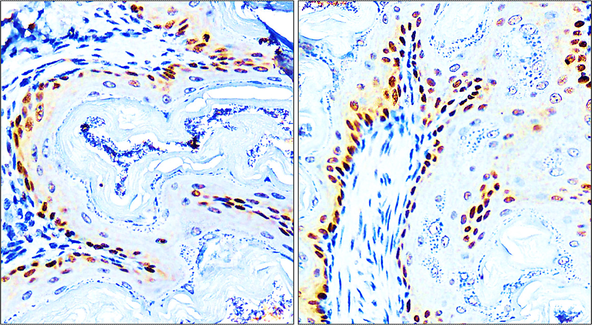 Customer feedback IR205-742 anti- p63 antibody IHC image