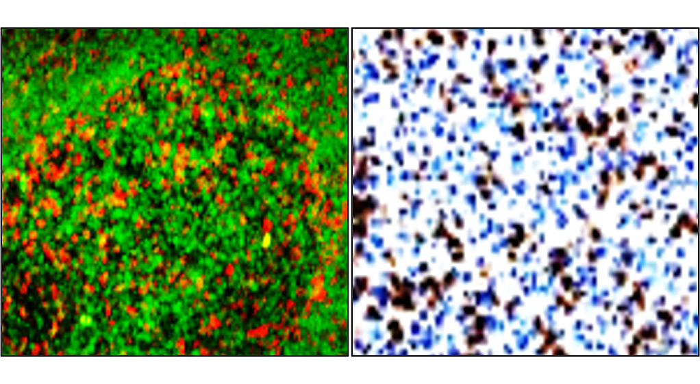 IRM005 anti- PD1 / CD279 antibody IHC image