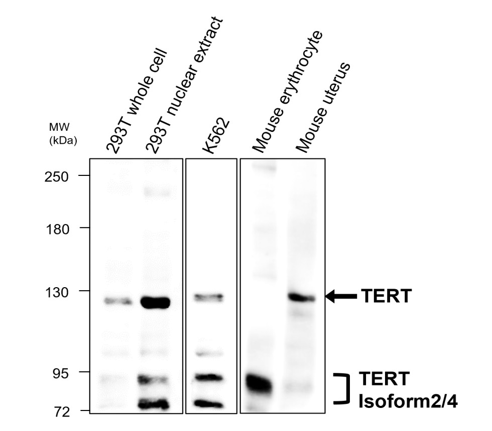 IR356-2 anti-TERT antibody WB image