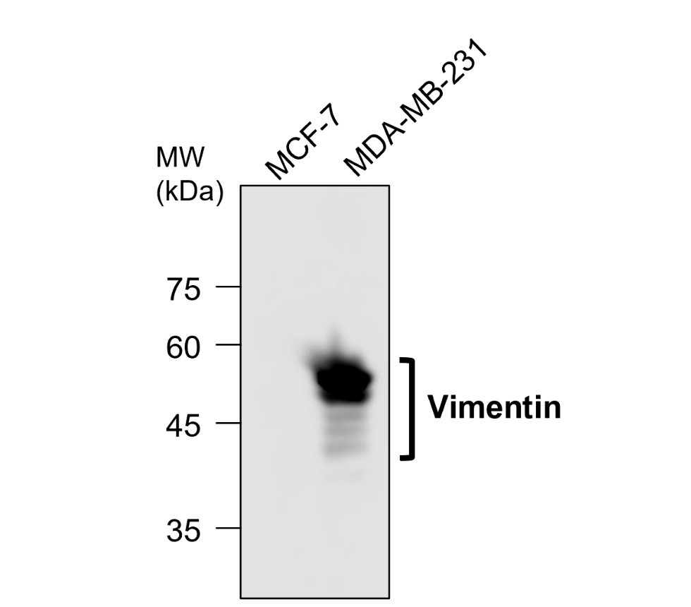  Vimentin antibody